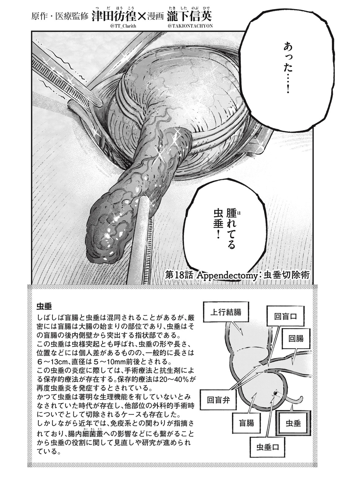 Koudo ni Hattatsu shita Igaku wa Mahou to Kubetsu ga Tsukanai - Chapter 18.1 - Page 2