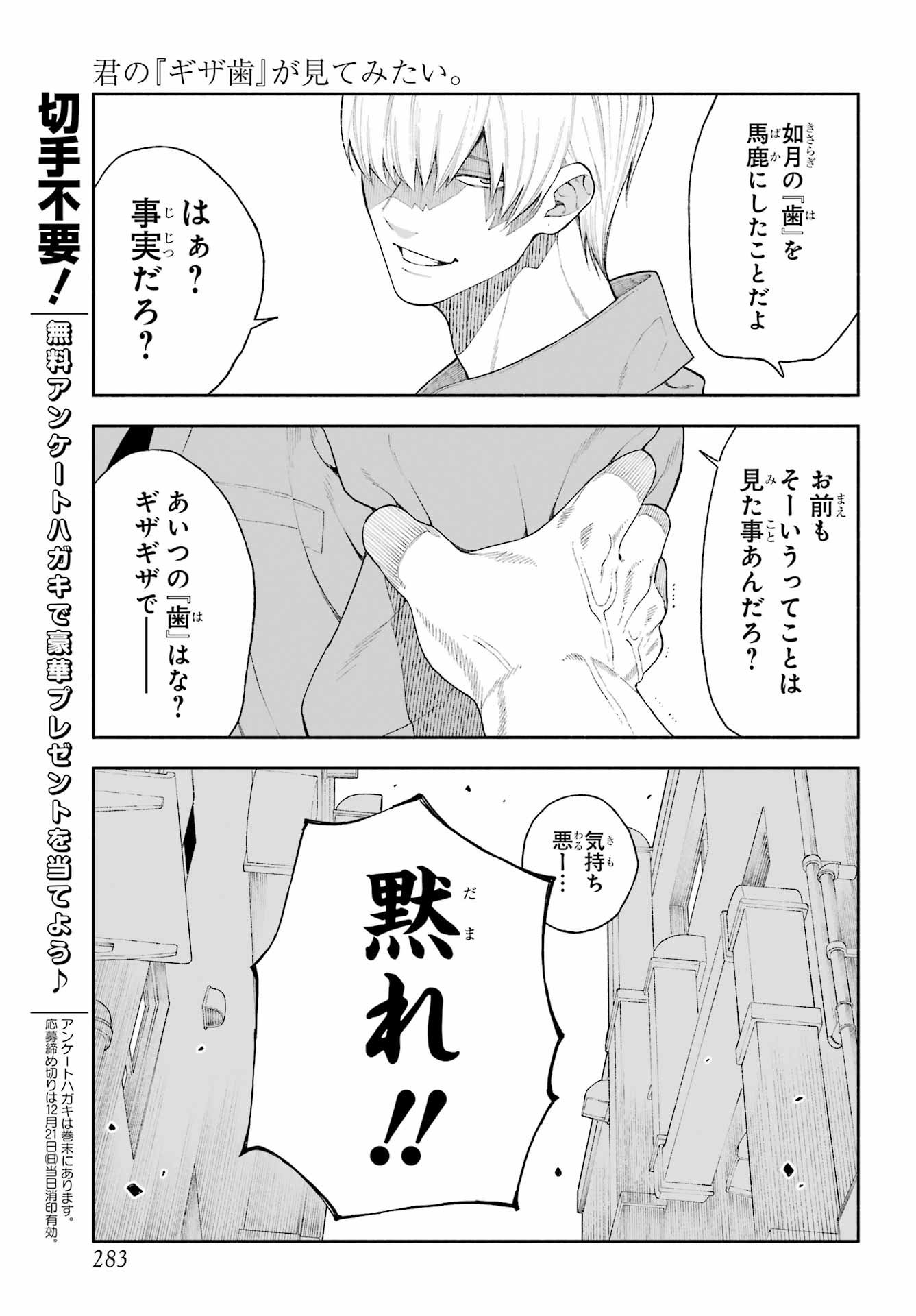 Kimi no "Gizaba" ga Mitemitai. - Chapter 7 - Page 7